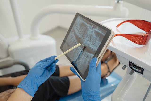 Dantų Implantavimas: Kam Reikalingas ir Kokia Nauda?